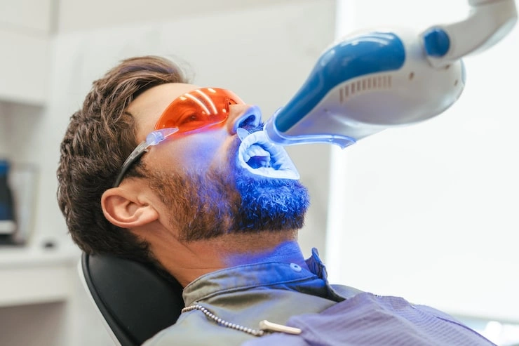 handsome bearded man patient whitening teeth modern dental clinic teeth treatment health care concept 695242 3447