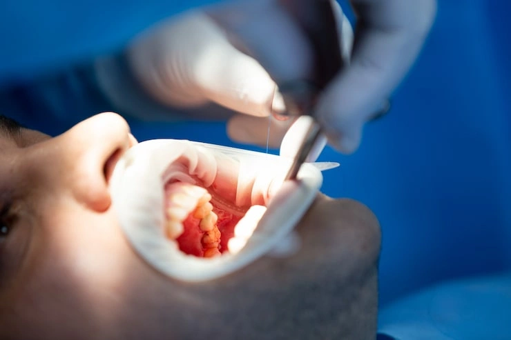 pacient dental clinic while operation 140725 7731