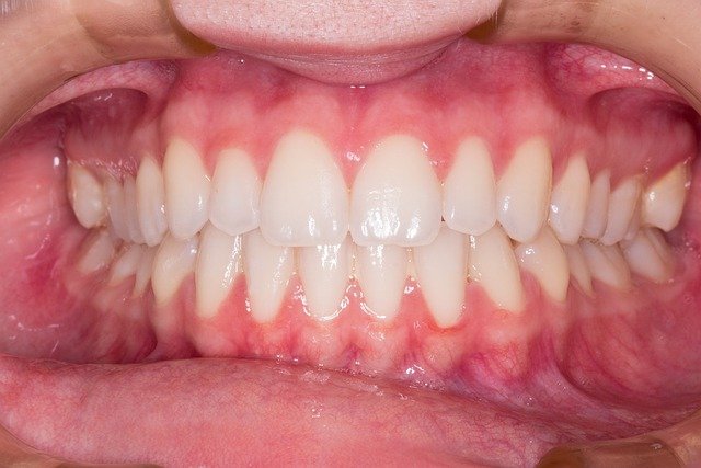 Best Cosmetic Dentist in Thornhill and What to Look For? 9 Choosing the best cosmetic dentist at a dental clinic in Thornhill